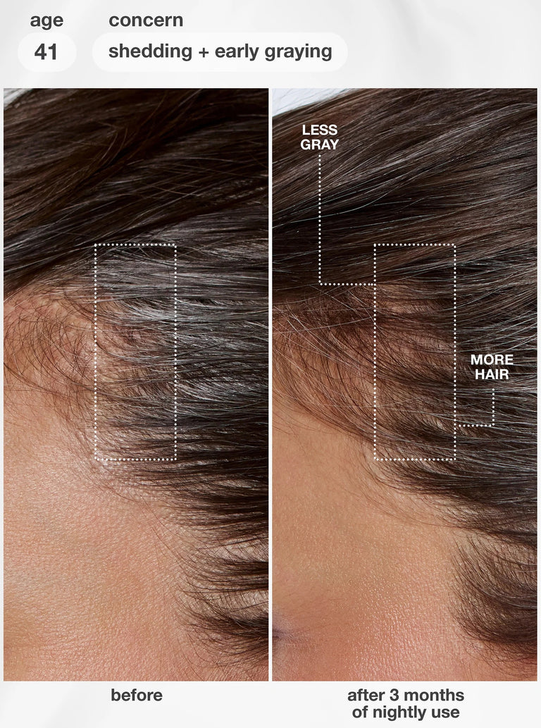 futureiq-biomimetic-hair-longevity-serum-90ml